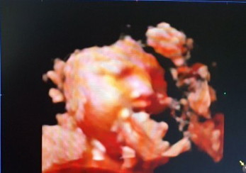 4D ultrasound 🥰