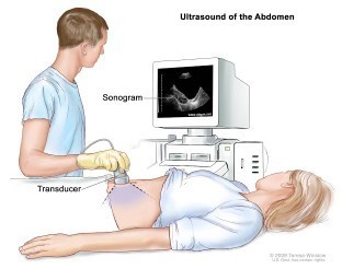 Transabdominal Ultrasound