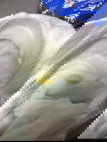 Maaf gambar popo baby . Saya nak tanya