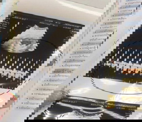 สอบถามหน่อยคะ