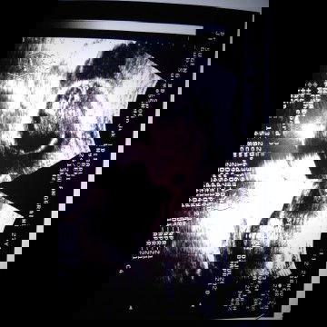 Numpang tanya bun, ini hasil usg 20w4d kta dktr ini ktanya usg 4d tapi kok item gini ya??