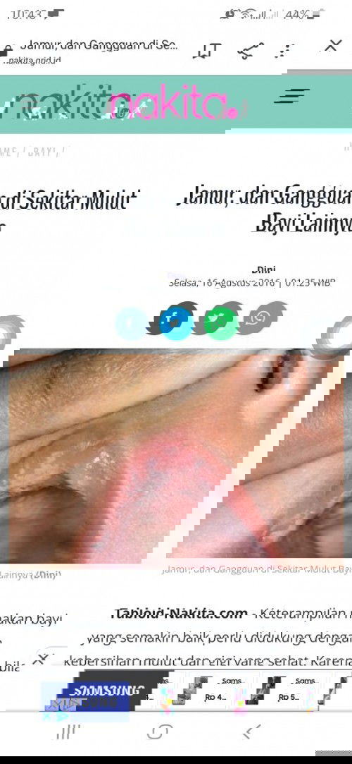 Mulut anak berjamur dan tidak mau makan