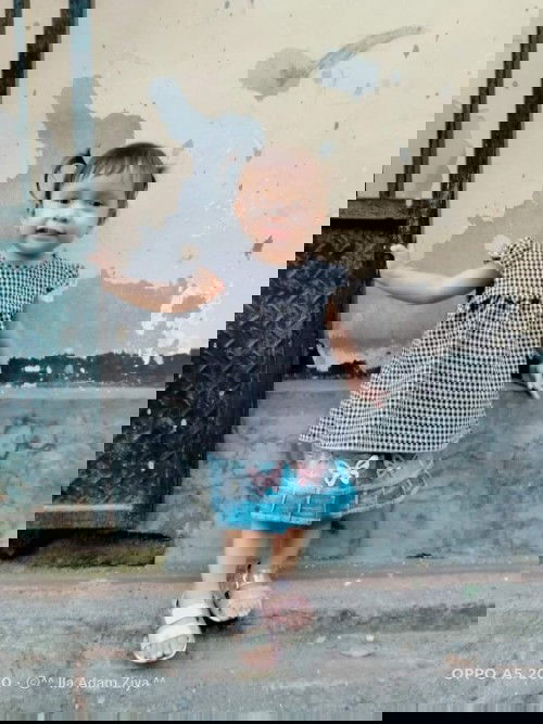 Kehamilan dengan kasus pre eklamsia positif 1