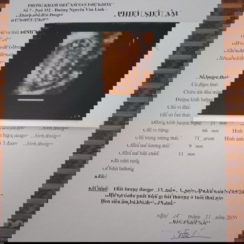 Xin ý kiến của mn ạ