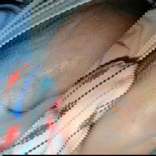 Ano po ba gamot sa rashes nato ni baby?