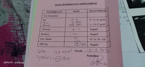 Bunda kasih saran dong saya hamil 31 minggu tapi hasil lab positif Hepatitis (HbS Ag) jadi kepikiran