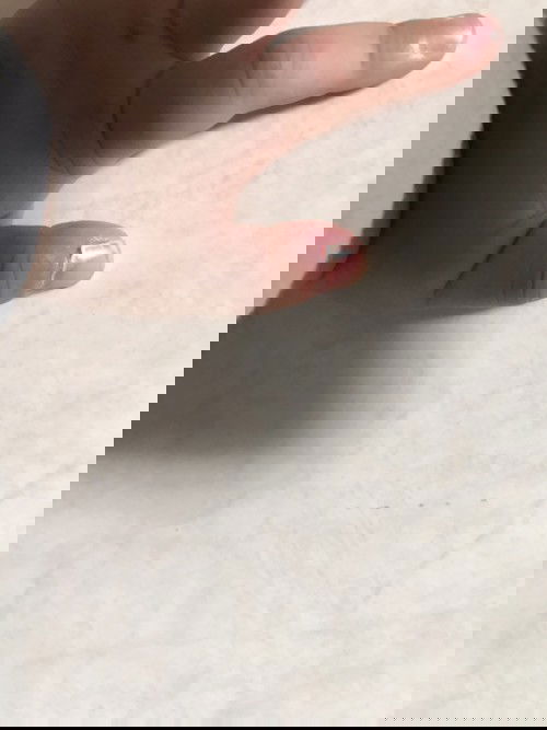 Kuku bayi setengah lepas