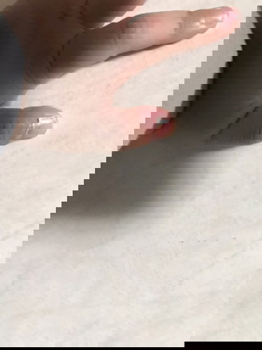 Kuku bayi setengah lepas