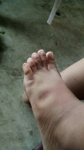 อาการแบบนี้อันตรายไหมคะ