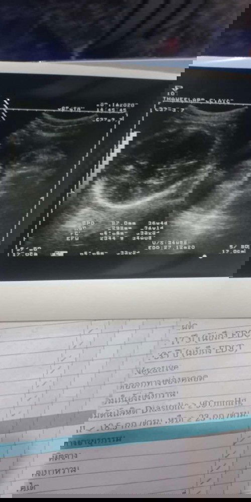 จากที่โพสต์ถามแม่ๆว่า ญ หรือ ช สรุปคือชายจ้า