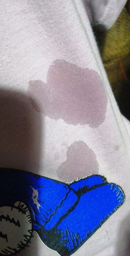 อยู่ๆน้ำนมไหล