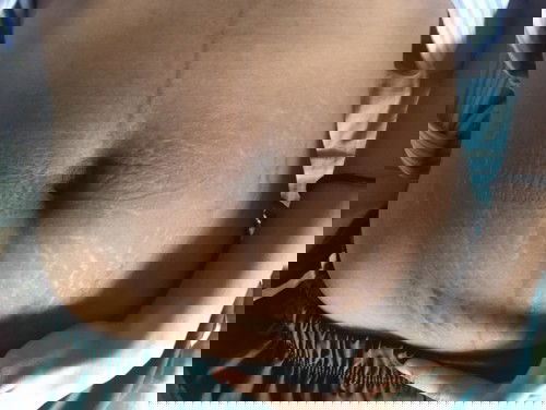 ยับมากเลยค่ะ ลูกคนเเรกยังมีโอกาสกลับไปเหมือนเดิมไหมคะ