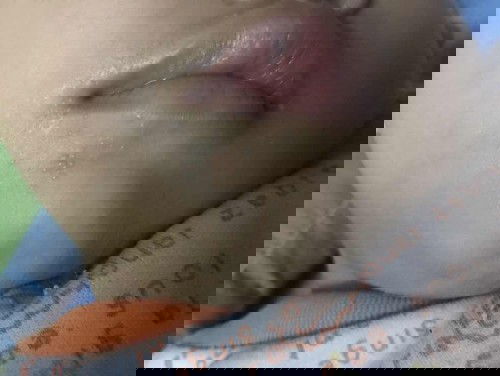 สอบถามแม่ๆหน่อยคะ