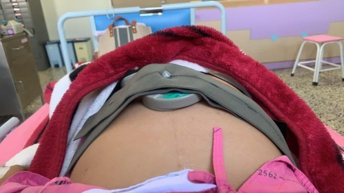 35+4 week ท้องแข็ง