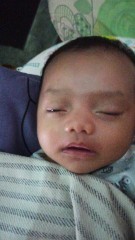 baby sariawan