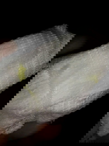 แบบนี้มูกหรือตกขาวค่ะ