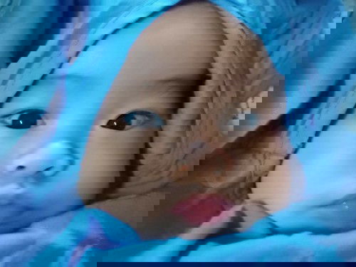 RSV ไม่ต้องรอให้มีไข้นะคะซิสสส..