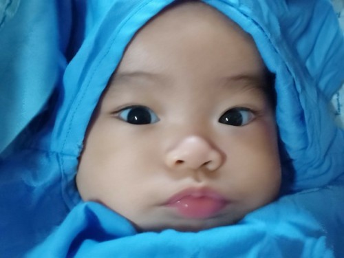 RSV ไม่ต้องรอให้มีไข้นะคะซิสสส..