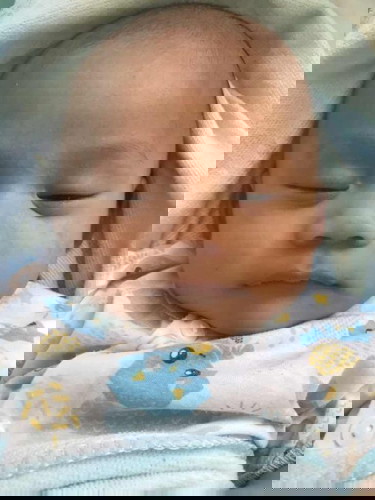 ลูกหน้าเป็นผื่นต้องใช้ยาอะไรค่ะถึงจะหาย