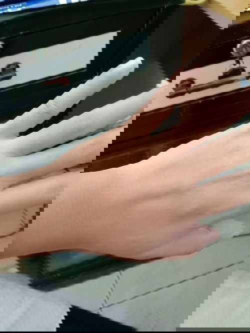 Gatal2 biang kringat saat Kehamilan 36 w