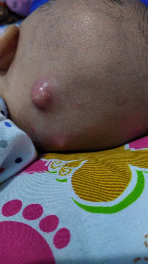 ?