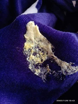 น้องแหวะนมเป้นสีเหลืองแบบนี้
ควรพาไปหาหมอไหมค่ะ