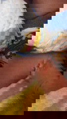 Kaki bernanah tidak tau penyebabny