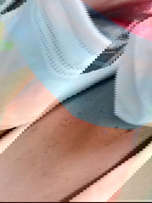 เม็ดไฝหรือเม็ดอะไร