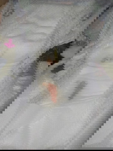 New born baby Urine with blood