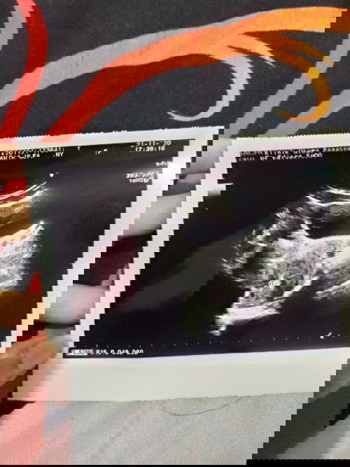 Usia Kandungan Pasti