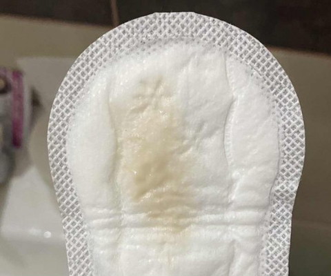 Yellowish or Brownish discharge? Help po