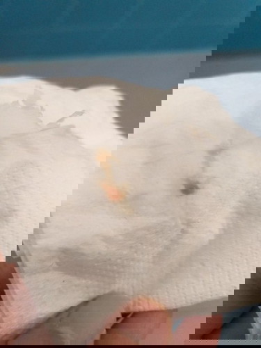 มีมูกเลือกค่ะ อายุครรภ์6w