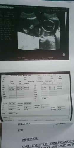 This is my ultra sound any advice for me.