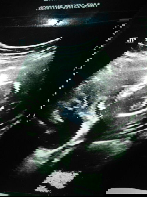 Assalamualaikum momies pernah ka gmbr scan baby mcm ni?