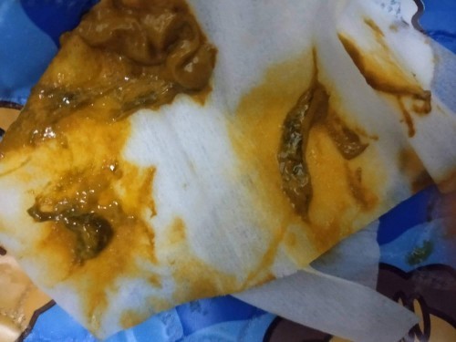 แม่ๆ ช่วยดูให้หน่อยค่ะ ตอนนี้กังวลใจมากๆ