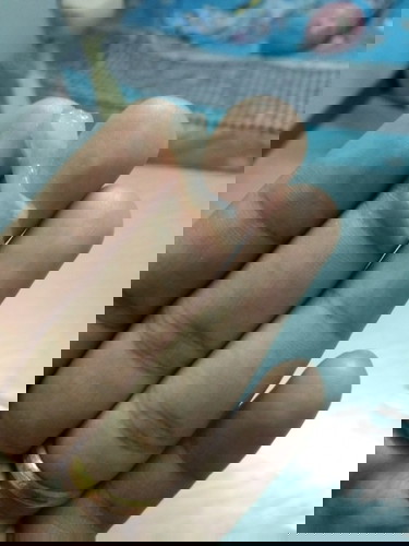 มีมูกใสๆออกมาเป็นอะไรไหมค่ะ