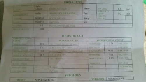 Di ko maintindihan result ko