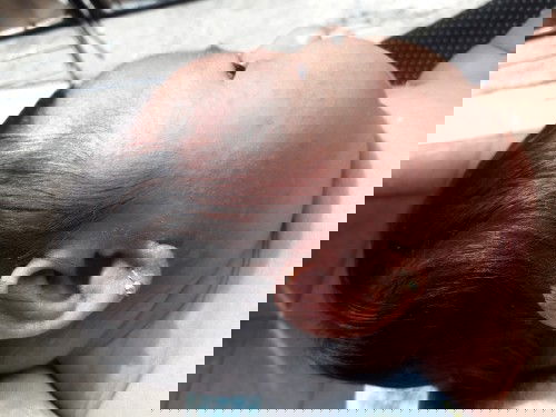 Telinga beruntusan kuning