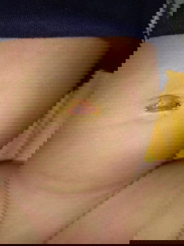 seizure o hind PA advice po