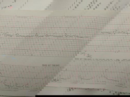 38+3 อยากคลอดแล้ววว