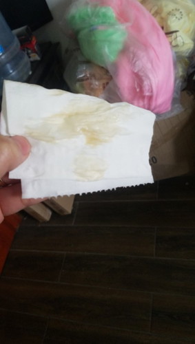 Em có ra ít dịch này, mom nào có bị giống em ko. ko phải máu.