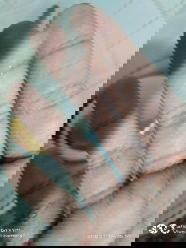 Internal examination