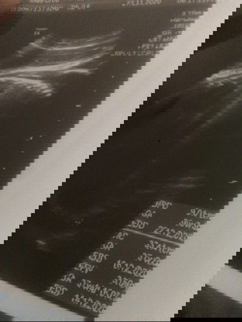 Adakah yang seperti saya?