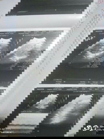 #3rdbaby hulaan nyo po hehe