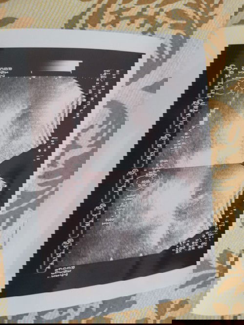 kantung kehamilan tdk sesuai UK