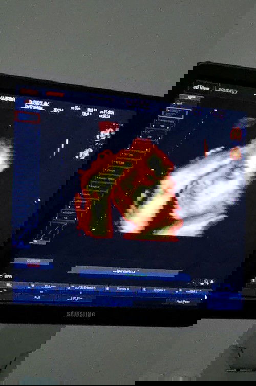 ซาว4D 31W ลุ้นๆว่าจะต้องผ่าหรือป่าวครับ