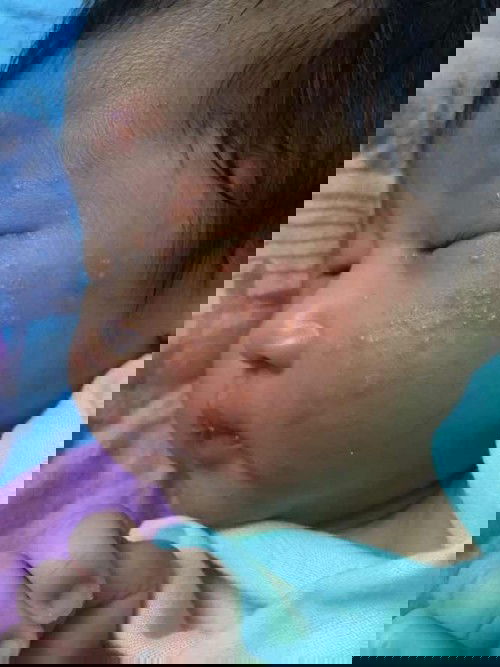 ผื่นอะไรค่ะ??