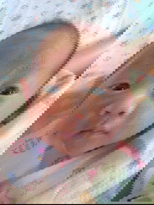 ผดผื่นบนหน้า