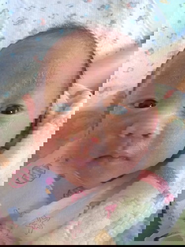 ผดผื่นบนหน้า