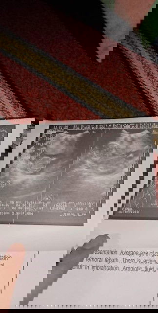 18 weeks❤️❤️❤️